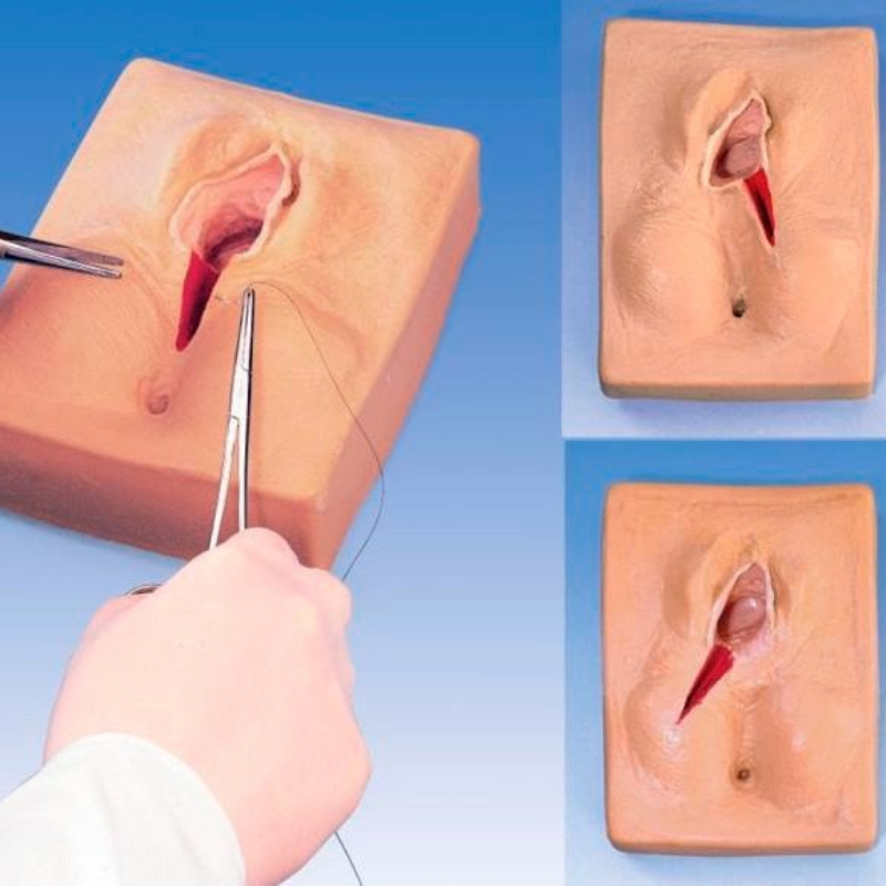 Khi mẹ sinh thường sẽ cần rạch tầng sinh môn