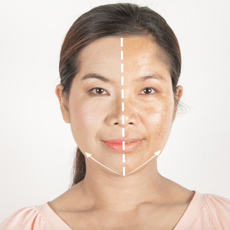 Tình trạng sam dạ sau sinh ở phụ nữ