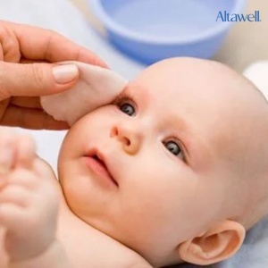 Vệ sinh mắt bé sạch sẽ để hạn chế tình trạng mắt đổ ghèn