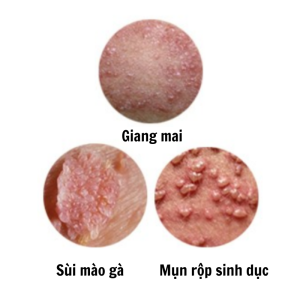Khi thấy các dấu hiệu lạ thì nên đi khám và tìm cách chữa trị