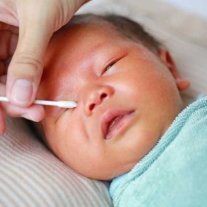 Cần vệ sinh mắt cho trẻ khi thấy bé ra nhiều gèn mắt